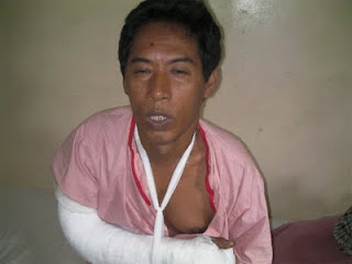 Jyoti Ranjan Chakma, victim of Muslim settler attack at Jaliapara