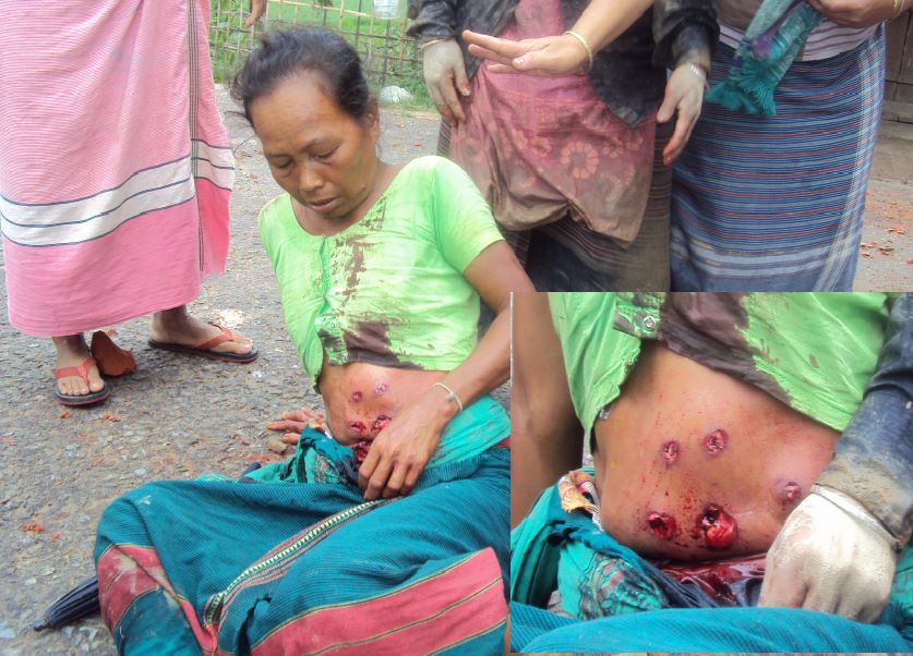 Chanchala Chakma victim of Bangladesh Police firing