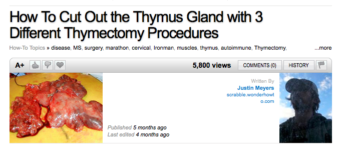 thymectomy