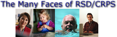 The Many Faces of RSD/CRPS