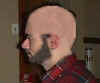 Bald.jpg (5494 bytes)