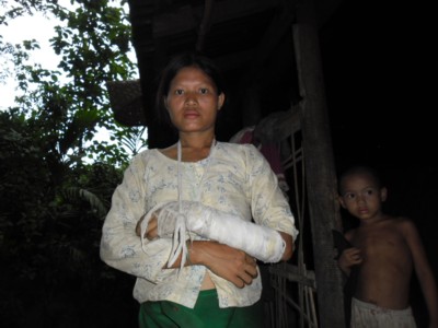 Chakma woman and victim of Teknaf