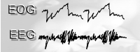 eeg_rem.jpg (12291 bytes)