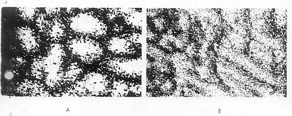 sekil 10- 6063 aluminyum mikroyap�s�