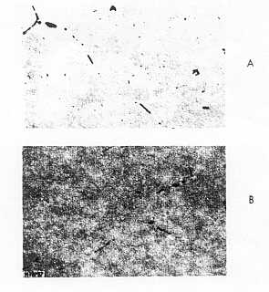 Biyetin ekstr�zyon i�in �s�t�lmas�