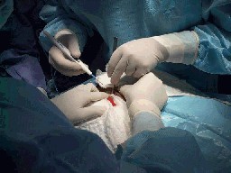 coccix2.jpg (16717 bytes)