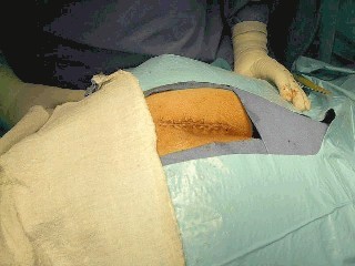 coccix3.jpg (22273 bytes)