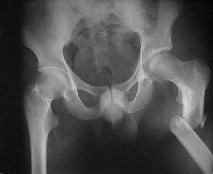 foto1.jpg (8129 bytes)