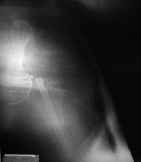 foto5.jpg (13806 bytes)