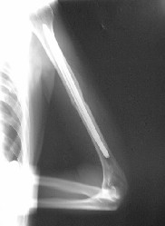 postoper1.jpg (8176 bytes)