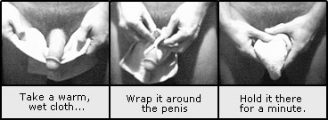 Exercise penis towel Penis Training