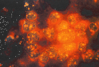 Click to visit M.D.Anderson cancer research page!