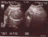 utz-28weeks&3days_03.jpg (69758 bytes)