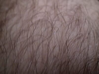 hair as in leg
