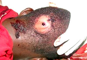 Aloysius Embwam: Shot Execution-style at the back of his head.