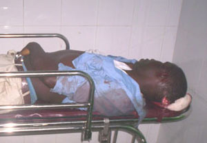 Nov 2006. The students were both shot point blank in the face around the University Junction. The corpses and the wounded were all rushed to the Buea Provincial Hospital Annex. 