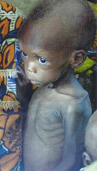 The hidden results of Corrupt African Leadership.