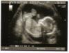 Baby Ultrasound - Nov 2004