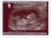 Baby Ultrasound - Sep 2004
