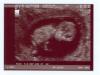 Baby Ultrasound - Oct 2004