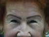 BROW AFTER REPAIR