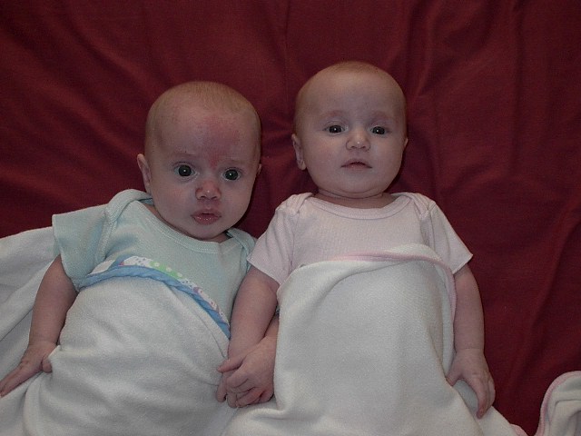 'No wait, this is my better side'