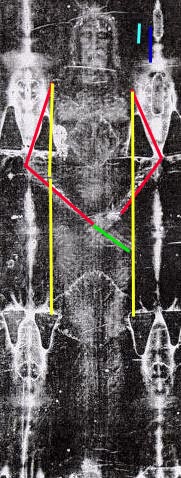 Anatomicly Incorrect