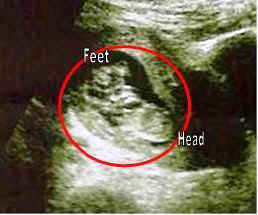 NewBaby2.jpg (12750 bytes)