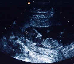 NewBaby.jpg (22269 bytes)