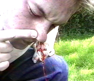 ant blood.jpg (52782 bytes)