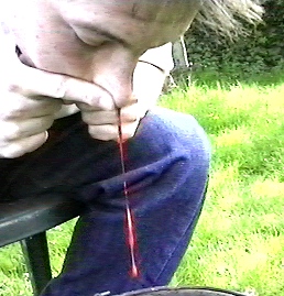 ant blood2.jpg (52219 bytes)