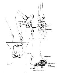 Click here for diagram