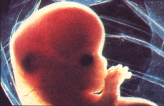 8 week old Baby in Mother's Womb