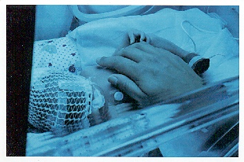 Linus som m&aring;ste sola f&ouml;r att bli av med gulsoten.