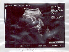 OBS! foten som sparkar i h&ouml;gra &ouml;vre h&ouml;rnet!?