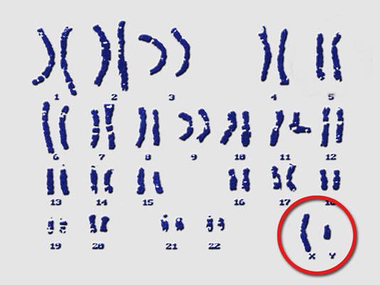 karyotype