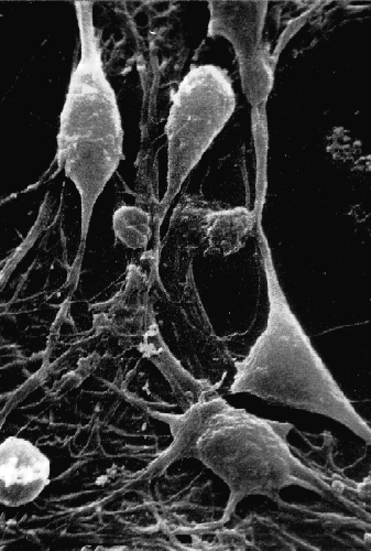 Algunas neuronas conectadas entre s