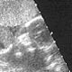 4-month ultrasound