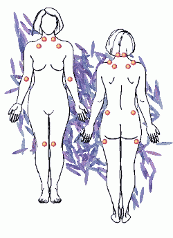 Tender Points of FMS