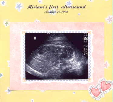 Miriam's 1st picture