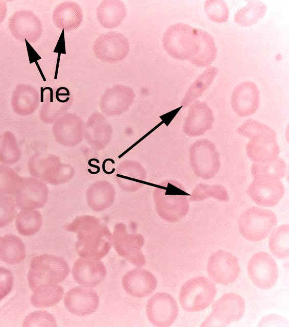 sickle.JPG (50741 bytes)