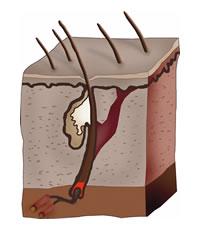 Håromsorg och hårförlust. Hair care.