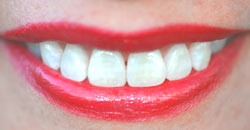 Οδοντικές διαδικασίες χωρίς πόνο. Dental care.