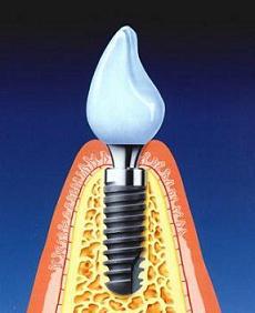 Dental care. Zdravé zuby. užitečné informace..