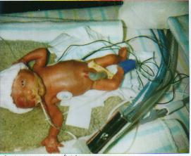 Imogen's first photo