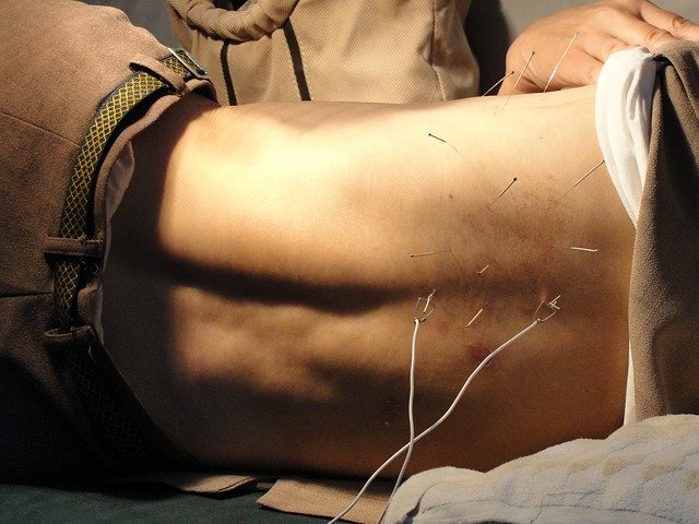 What To Expect During Your First Acupuncture Visit