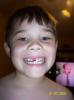 Lost another Tooth