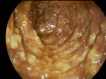 digestive.gif (100918 bytes)