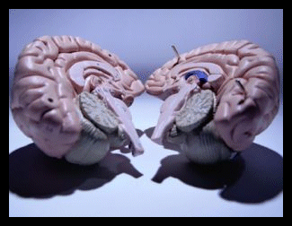 A Split Brain