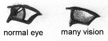 normal v. many vision